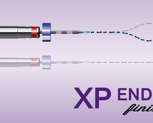 XP-endo Finisher fil og logo